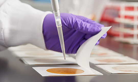 A food safety lab technician and gloves carrying out quality indicator testing using a Petrifilm Plate.